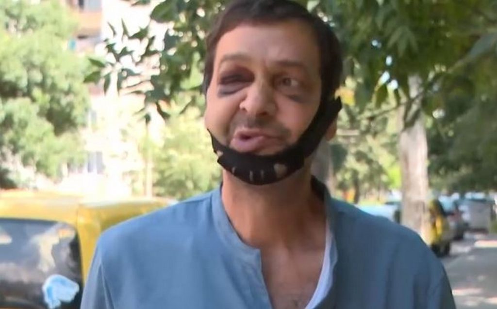 „Пребиха ме за енергийна напитка“: Таксиметрови шо